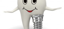 9 Benefits Of Dental Implants