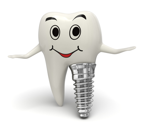 9 Benefits Of Dental Implants