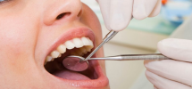 Getting Dental Implants