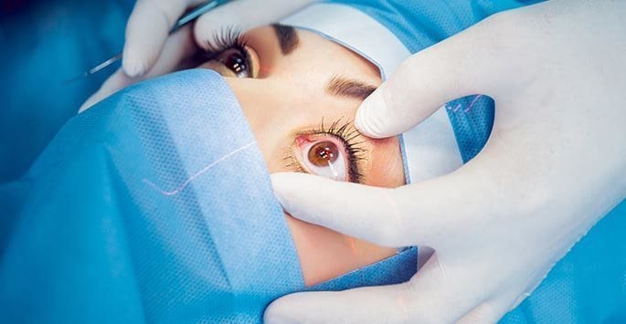 Cataract Surgery